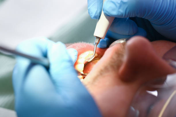 Best Emergency Dental Care for Broken or Chipped Teeth in Ledbetter, KY