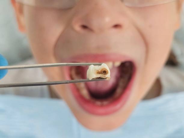 Best Emergency Denture Repair in Ledbetter, KY