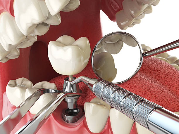 Best Cosmetic Emergency Dentistry in Ledbetter, KY